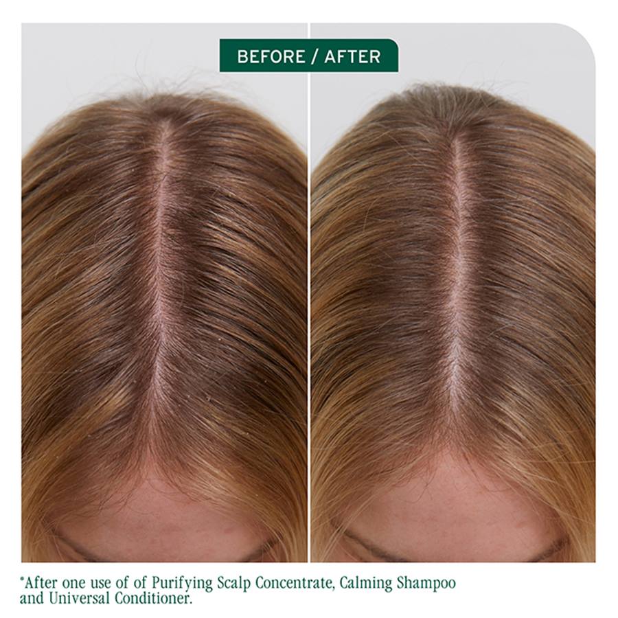 Biolage Scalp Sync Calming Shampoo 400ml - Image 4